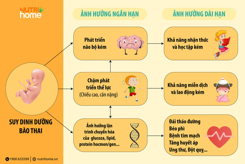 Ảnh hưởng nghiêm trọng của suy dinh dưỡng bào thai