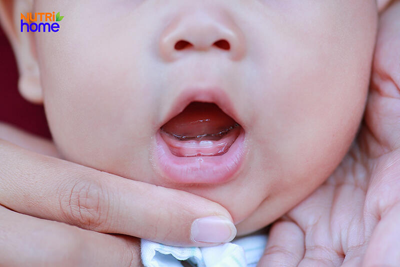 Trẻ mọc răng cửa, răng hàm trên và dưới 