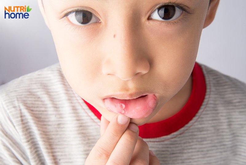 phân biệt biếng ăn bệnh lý