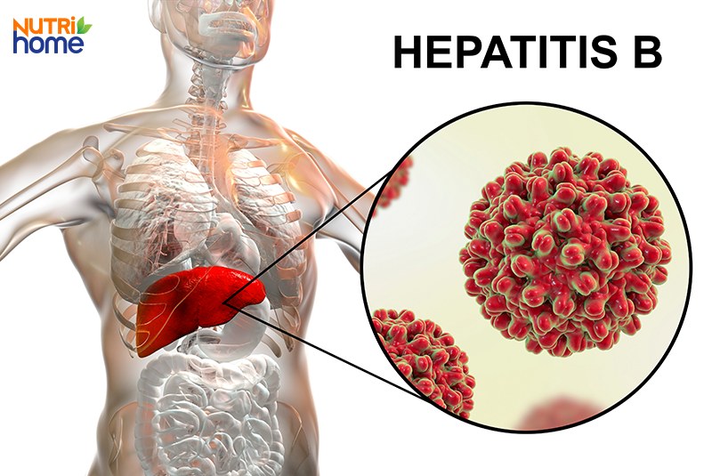 viêm gan siêu vi B, HBV