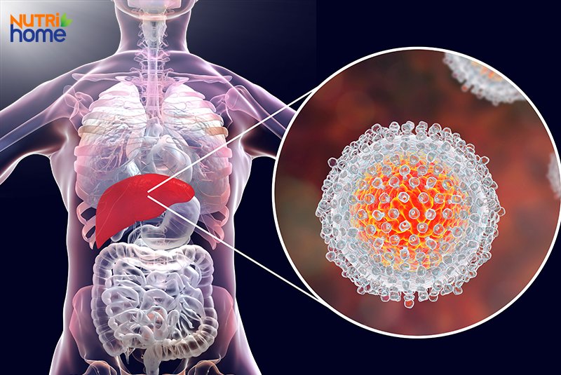 viêm gan siêu vi C, HCV