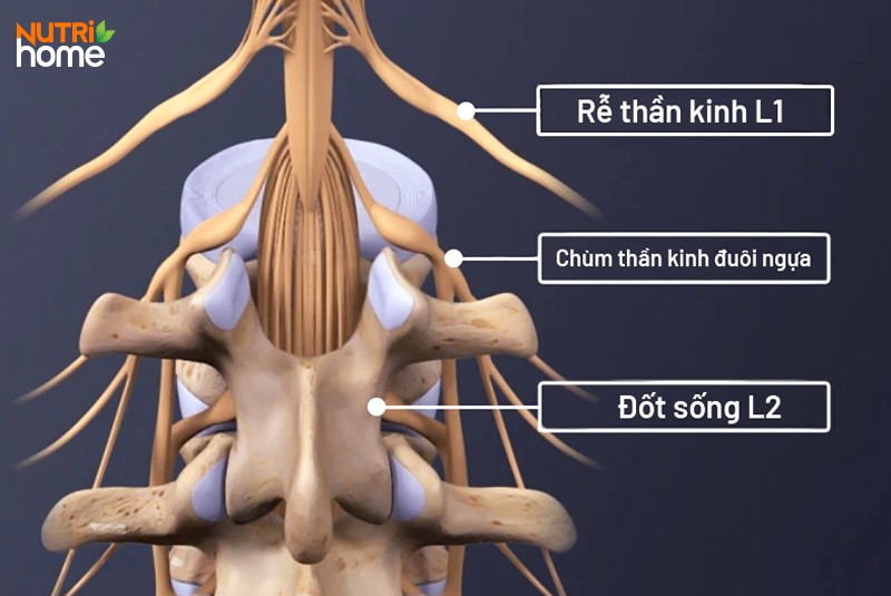 Thoát vị đĩa đệm có nguy hiểm không?