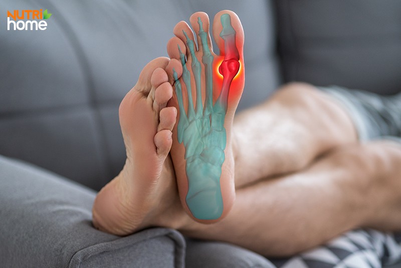 Người bị gout ăn dứa có tốt không?