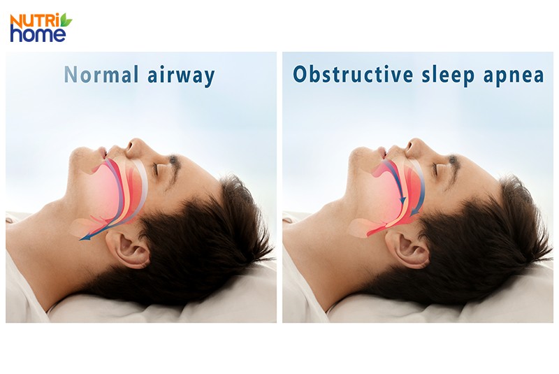 Mất ngủ là dấu hiệu của bệnh gì?