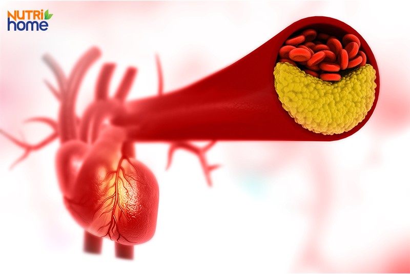 Thừa cholesterol có sao không?