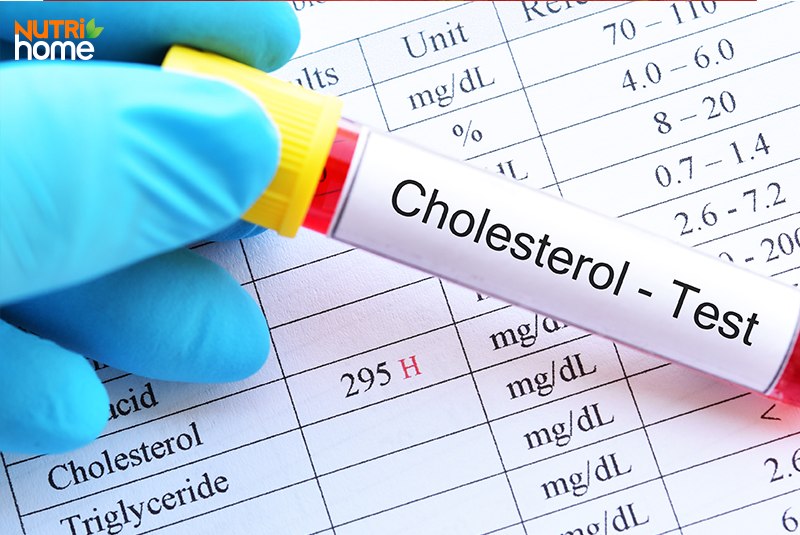 Chỉ số cholesterol bao nhiêu là cao?