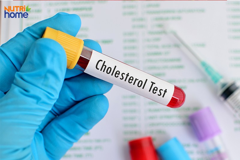Chẩn đoán cholesterol trong máu cao bằng cách nào?