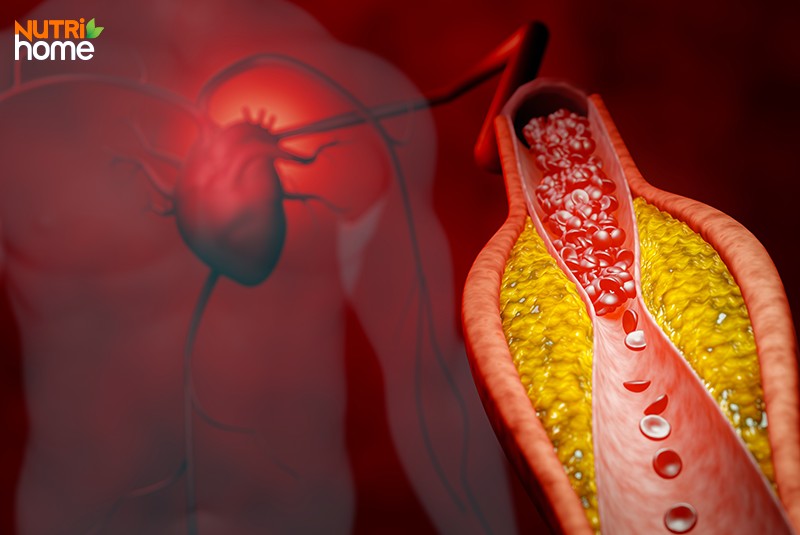 Thừa triglyceride có sao không?