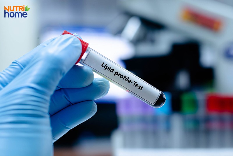 Lipid máu bình thường là bao nhiêu?