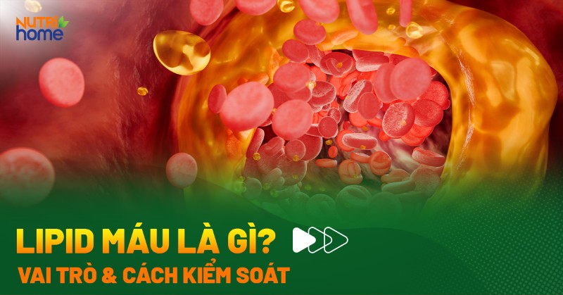 Lipid máu là gì? Thành phần, vai trò và cách kiểm soát