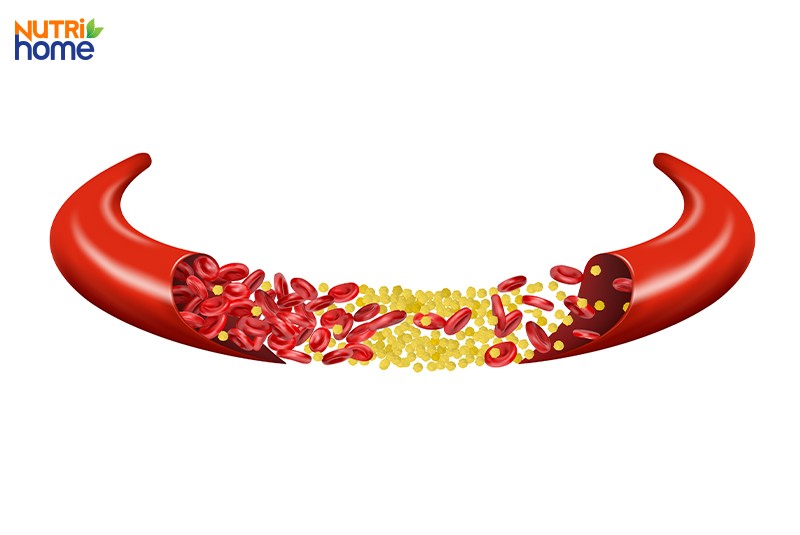 Thành phần lipid máu bao gồm những gì?
