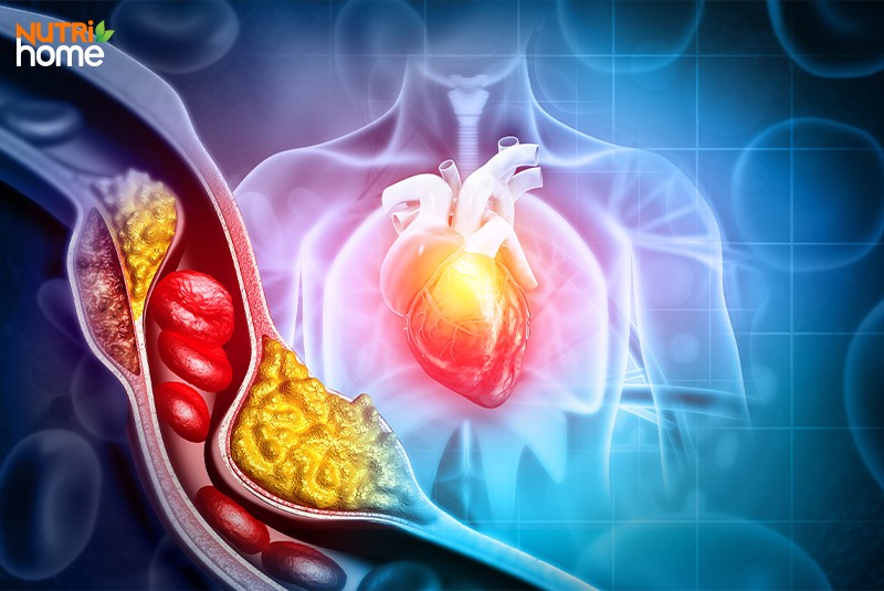 https://www.shutterstock.com/vi/image-photo/blood-sampling-tube-lipid-profile-analysis-2371891975Các bệnh thường gặp do lipid máu bất thường