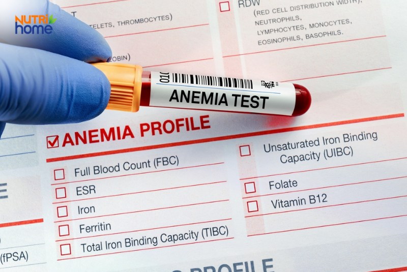 Chẩn đoán bệnh thiếu máu não