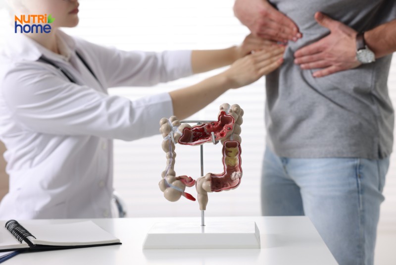Cách phòng ngừa bệnh đại tràng và giảm đau tại nhà