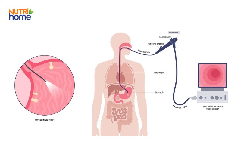 Chẩn đoán bệnh đường tiêu hóa