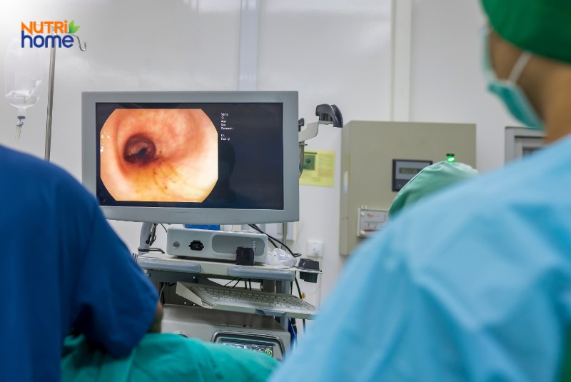 Các xét nghiệm kiểm tra chức năng đại tràng