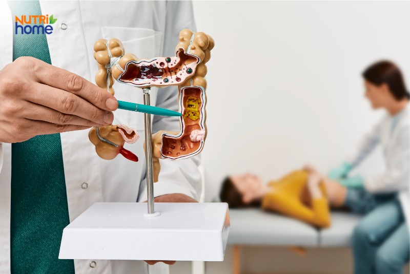 Làm gì khác để có đại tràng khỏe mạnh?