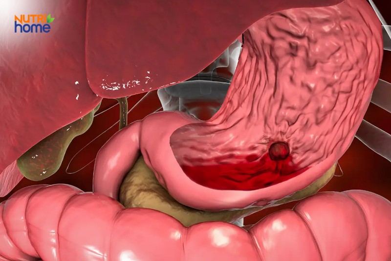 Viêm xung huyết hang vị có nguy hiểm không?
