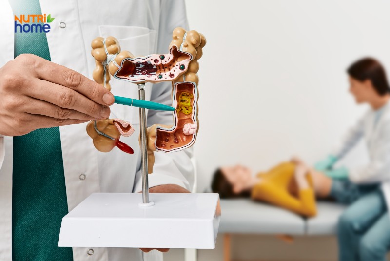 Nghi mắc bệnh viêm ruột: Khi nào đi khám bác sĩ?
