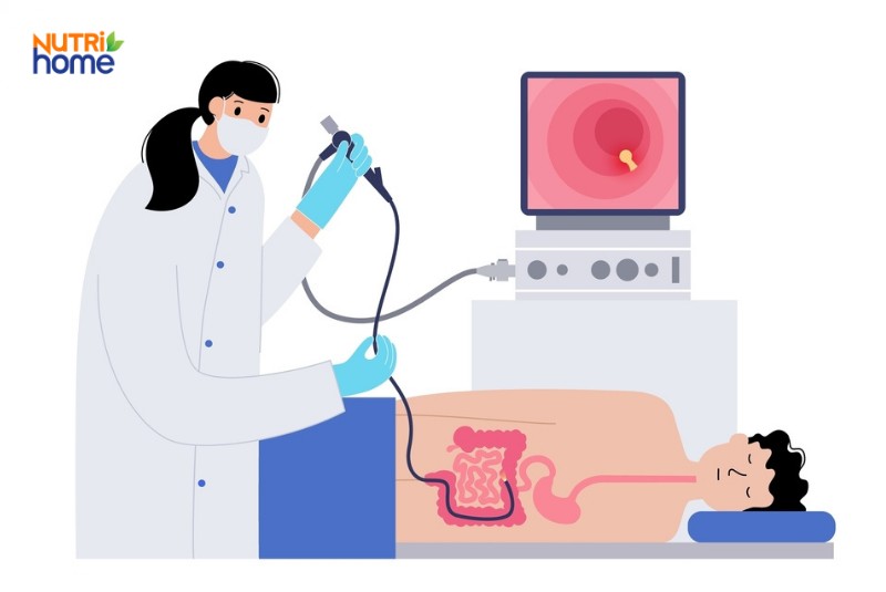 Chẩn đoán bệnh viêm đường ruột, nội soi