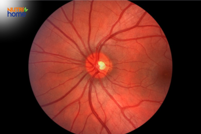 cấu tạo mắt với nhiều dây thần kinh thị giác (optic nerve)