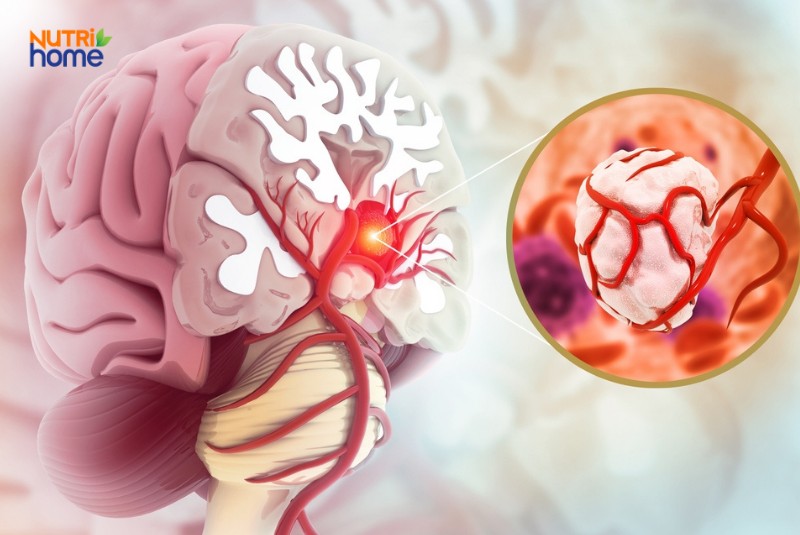 Khối u có nguy hiểm không?