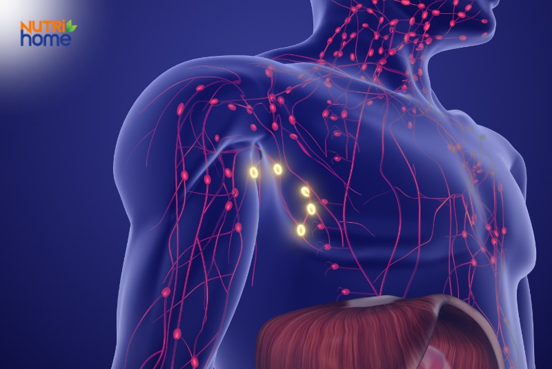 Các loại u ác tính thường gặp, U lympho