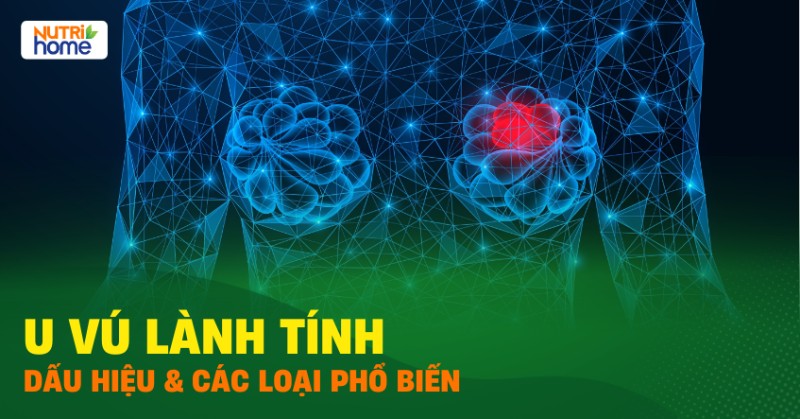 u vú lành tính