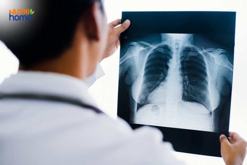 Các xét nghiệm chức năng phổi thường gặp