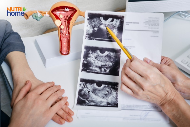 Chẩn đoán giảm ham muốn ở nữ giới