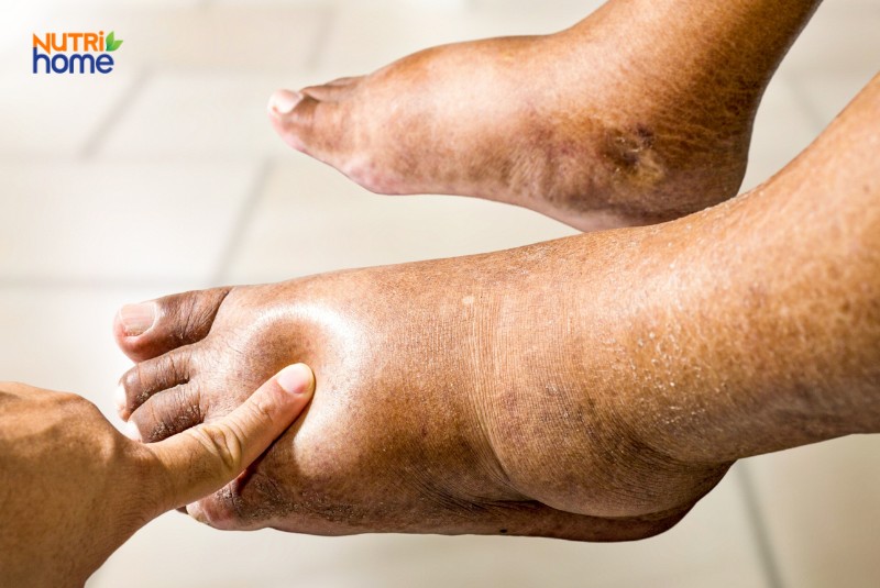 uống nhiều nước quá có tốt không