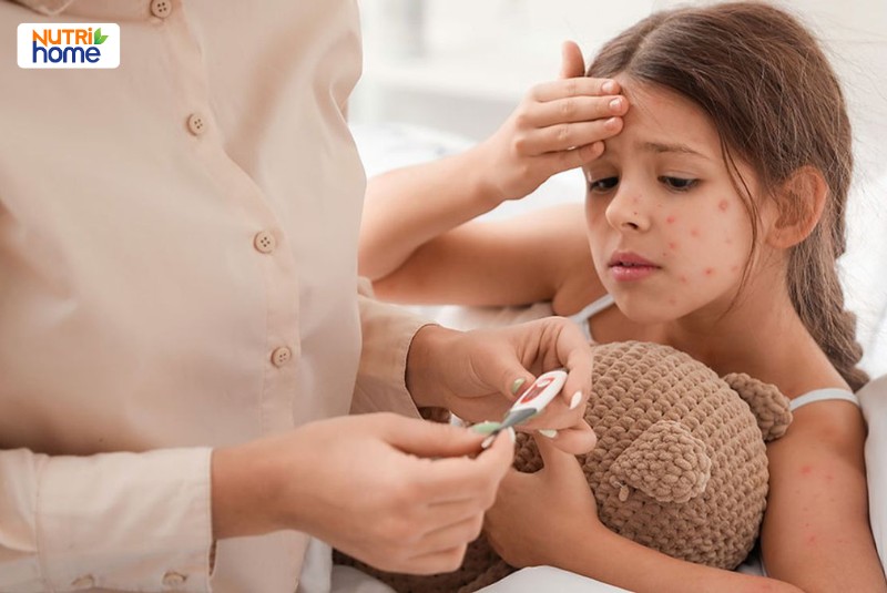 dấu hiệu bị thủy đậu