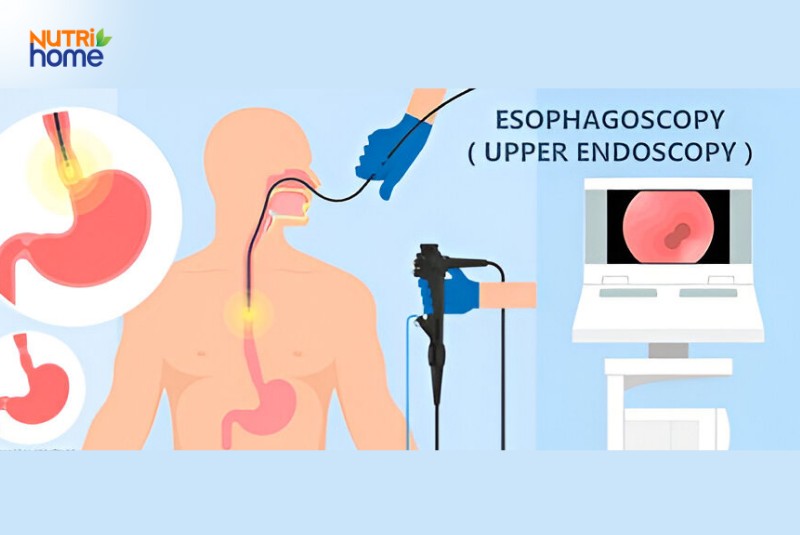 Chẩn đoán và phương pháp kiểm tra thực quản