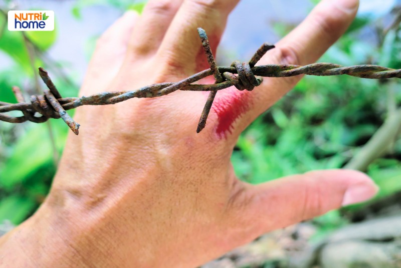 Uốn ván lây qua đường nào?