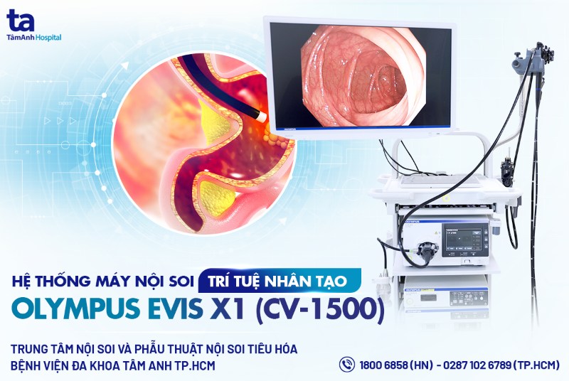 Ứng dụng AI trong nội soi tiêu hóa