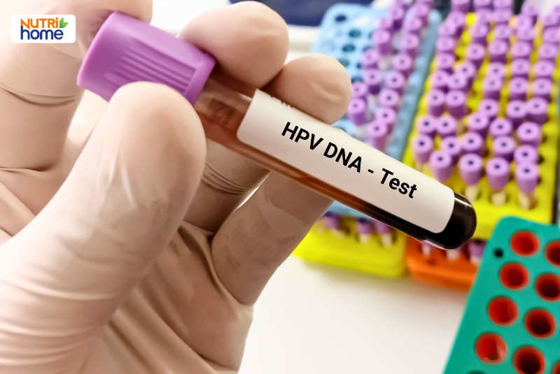 Xét nghiệm và tầm soát các tuýp HPV