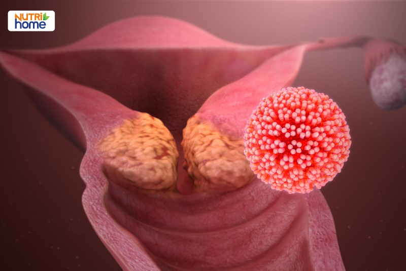 Biến chứng tiềm ẩn liên quan đến HPV