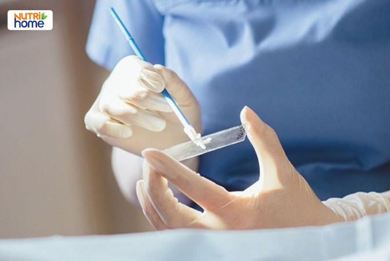 Cách điều trị HPV type 18