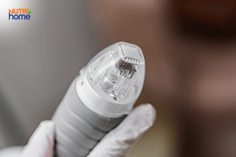 Cách điều trị bọng mắt hiệu quả