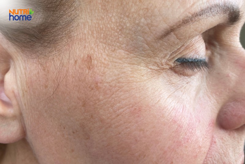 Da mặt phụ nữ lớn tuổi với nếp nhăn và đốm sắc tố do lão hóa tự nhiên