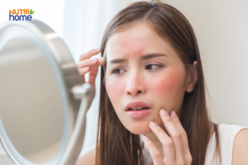 Cô gái lo lắng soi gương khi da mặt bị đỏ rát, biểu hiện của vấn đề da liễu