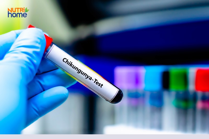 Ống nghiệm xét nghiệm máu chẩn đoán virus Chikungunya trong phòng thí nghiệm