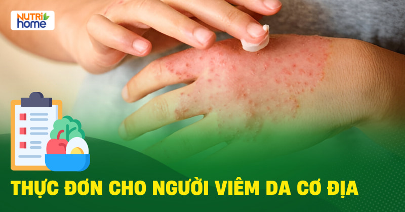 Thực Đơn Cho Người Viêm Da Cơ Địa Giúp Giảm Viêm Và Ngứa Da Thực Đơn Cho Người Viêm Da Cơ Địa