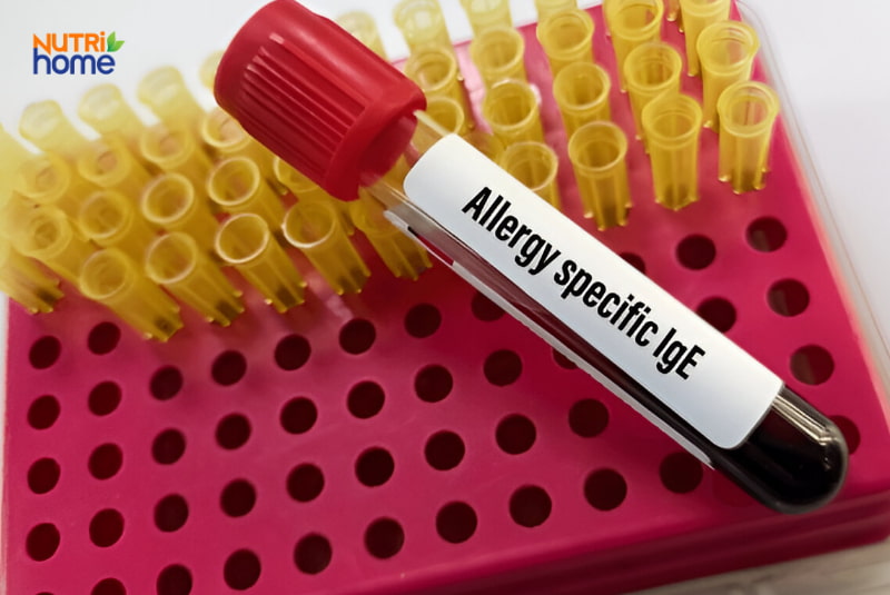 Ống nghiệm xét nghiệm IgE đặc hiệu phát hiện dị ứng liên quan viêm da cơ địa