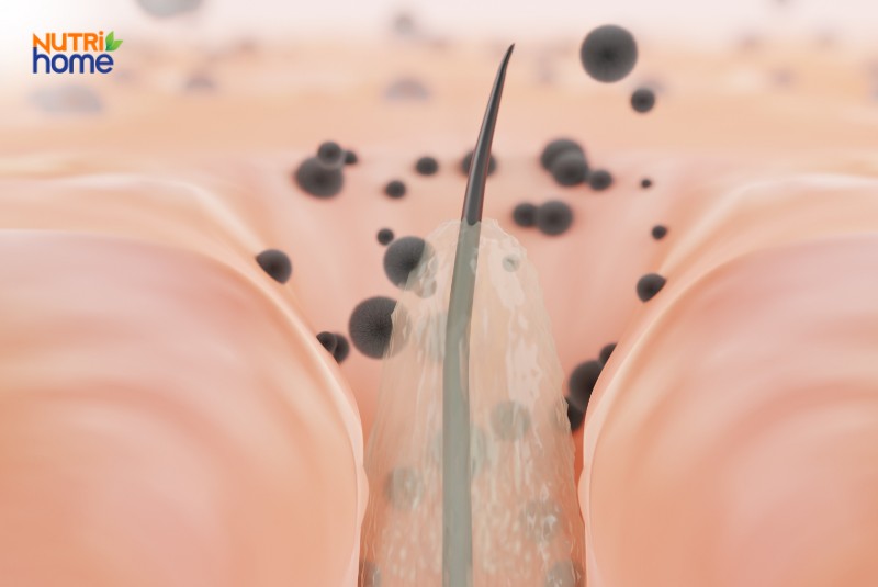 Mô Phỏng Bã Nhờn Và Vi Khuẩn Tích Tụ Gây Bít Tắc Lỗ Chân Lông