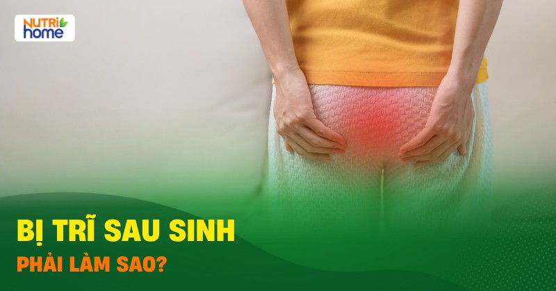 Bị Trĩ Sau Sinh