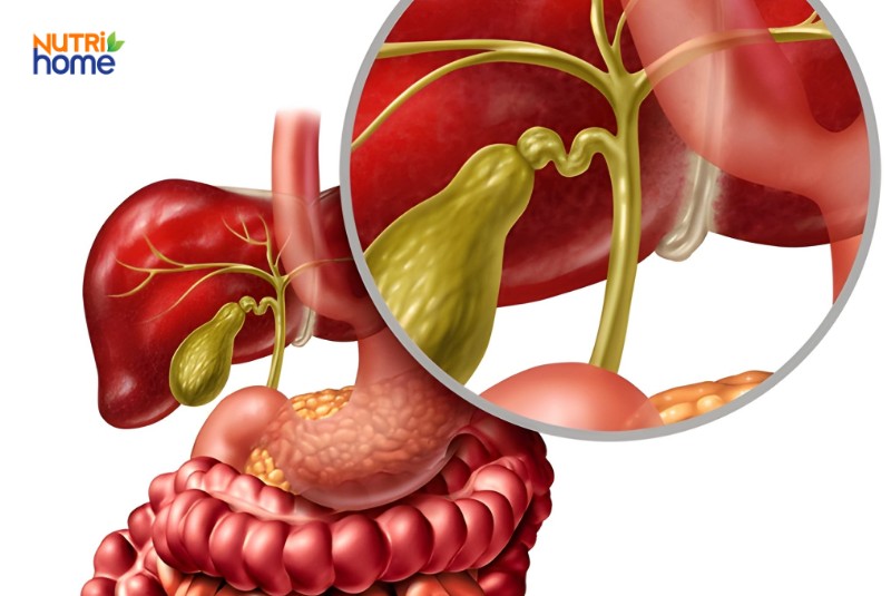 Hình ảnh giải phẫu túi mật và ống dẫn mật, vai trò trong tiêu hóa chất béo