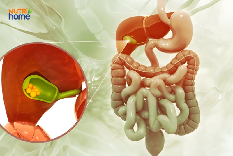 Mô phỏng hệ tiêu hóa và đường dẫn mật, phóng to túi mật có sỏi