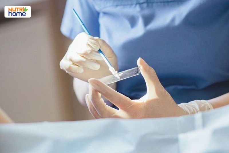 Bác sĩ thực hiện lấy mẫu tế bào cổ tử cung trong xét nghiệm Pap smear