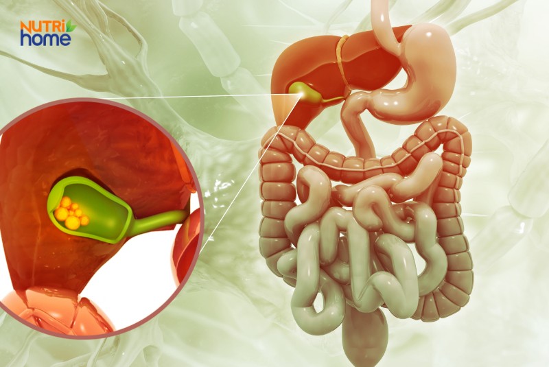 Mô phỏng giải phẫu hệ tiêu hóa và túi mật bị sỏi gây tắc nghẽn dịch mật